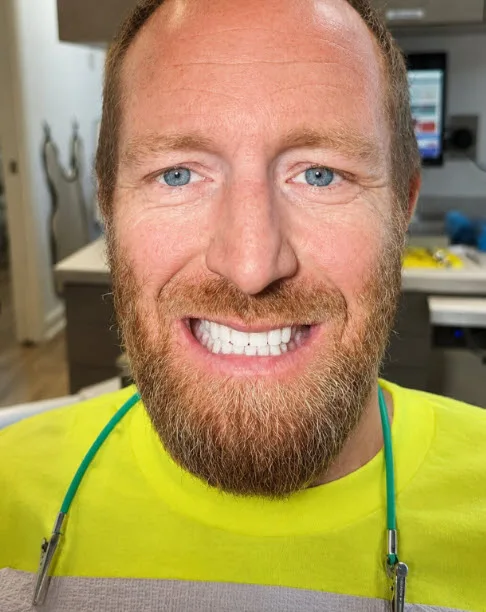 After implant-supported denture rehabilitation patient portrait