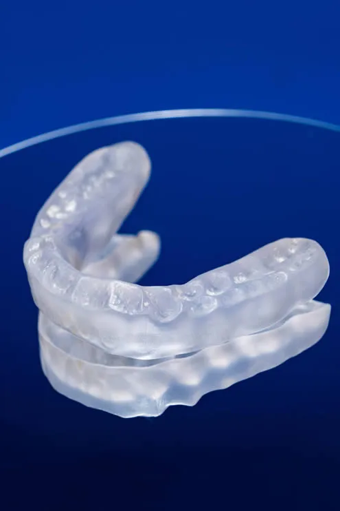Teeth grinding mouth guard at Detroit Dentist