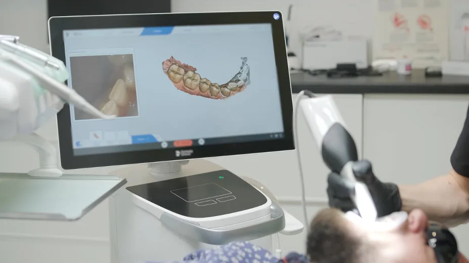 Digital Intraoral Scanner at OC Premier Dentistry